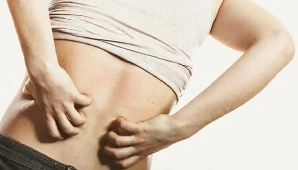 久坐后背癢 久坐后背癢